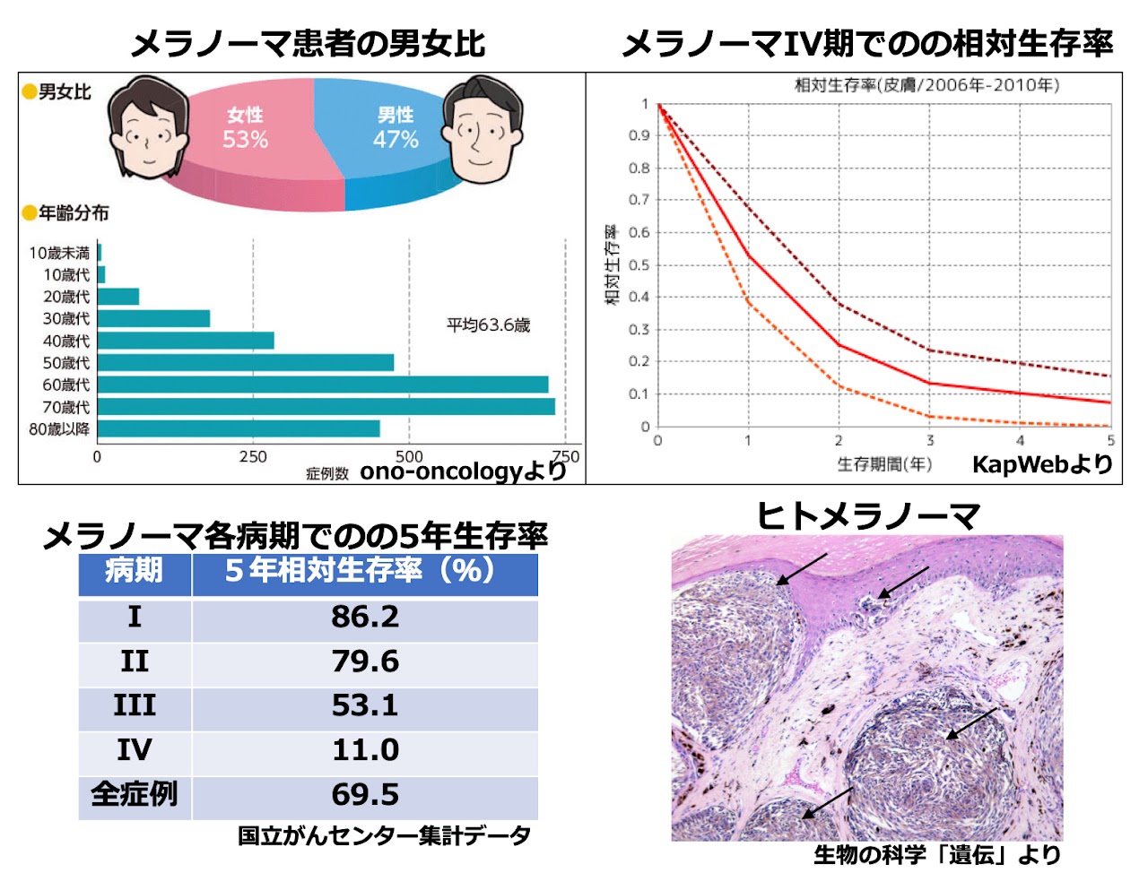 メラノーマの生存率